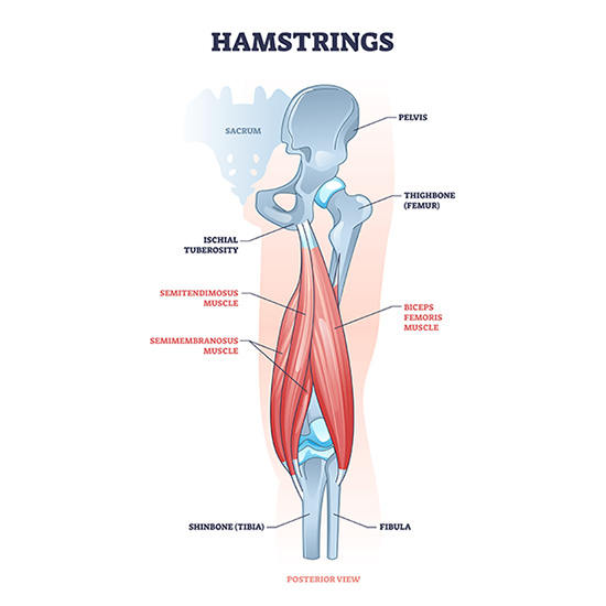 A colorful medical illustration of the hamstring muscle group, with detailed anatomy of the biceps femoris, semitendinosus, and semimembranosus muscles.